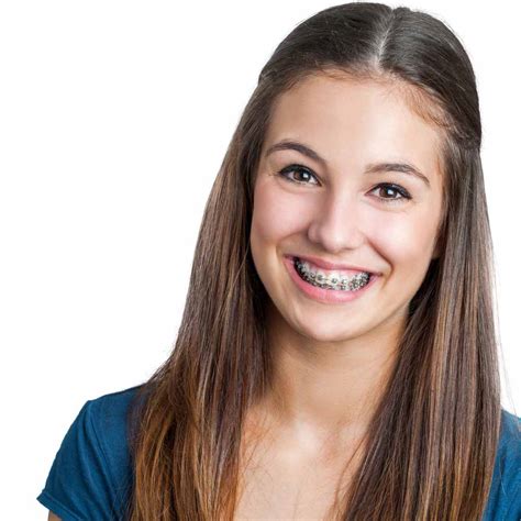 teens braces porn|All About Orthodontia (for Teens) .